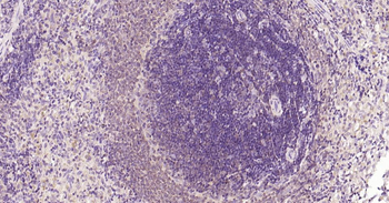 Bcl-2 Recombinant Rabbit Monoc