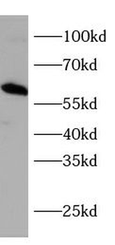 CDKN1C Antibody抗体，orb1292515，b