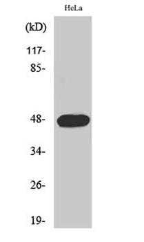 Cyclin E1 (phospho Thr395) rab