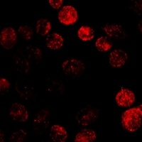 Cytochrome P450 19A1 Antibody抗