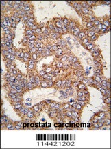 TRPM8 Antibody抗体，orb1262699，bi
