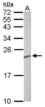 TC21 antibody [N1C3]抗体，orb5567