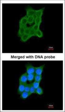 CRTAP antibody [N2C3-2]抗体，orb5