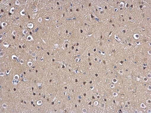 MAD2L1 antibody [C2C3], C-term