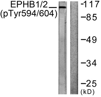 EphB1/2 (phospho Tyr594/604) r