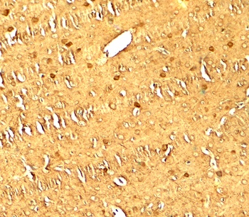 MAP1LC3 Antibody抗体，orb1239475，