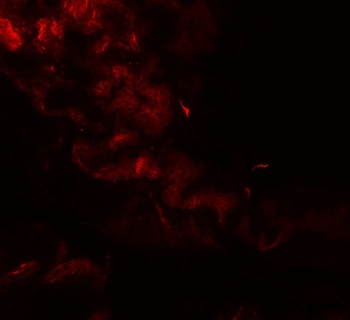 GOLGIN97 Antibody抗体，orb1239741