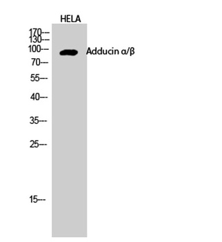 Adducin α/β rabbit pAb抗体，orb76