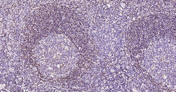 5 Lipoxygenase Recombinant Rab