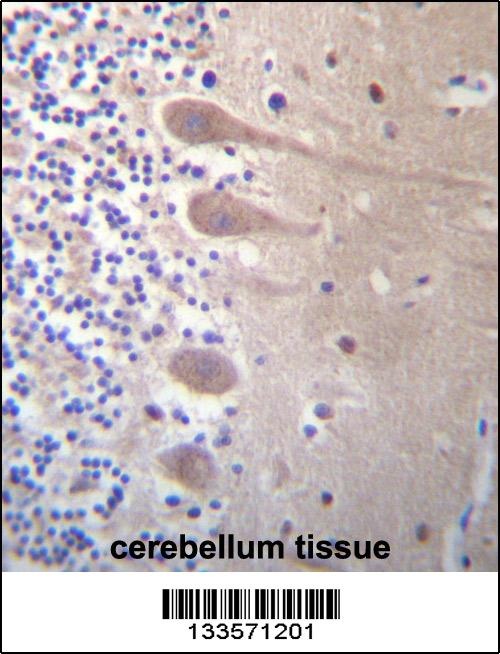 ZNF764 Antibody抗体，orb1269017，b