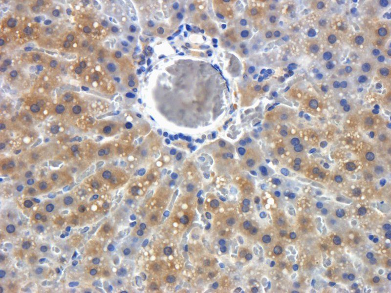 LOXL2 antibody抗体，orb100924，bio