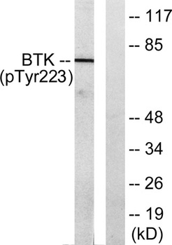 Btk (phospho Tyr223) rabbit pA