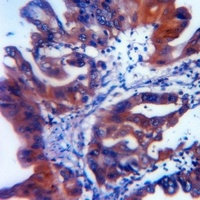 ATG5 Antibody [KO/KD Validated