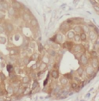 IRS1 Antibody抗体，orb756628，bior