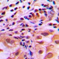 FOXO1 (Phospho-S256) Antibody抗