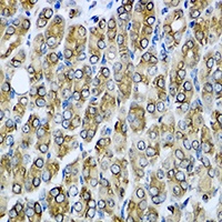 RAC2 Antibody抗体，orb215509，bior