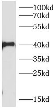 TNFAIP3 Antibody抗体，orb756532，b