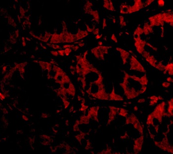 STEAP2 Antibody抗体，orb1238877，b