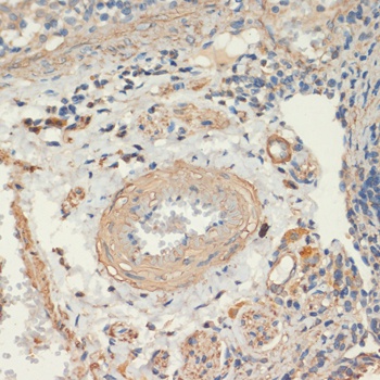 MYH11 Antibody抗体，orb1261338，bi