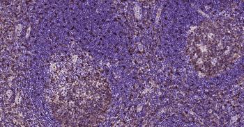 STMN1 Mouse Monoclonal Antibod