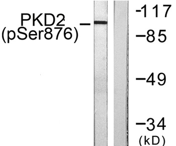 PKD2 (phospho Ser876) rabbit p