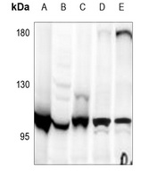 Apolipoprotein B Receptor Anti