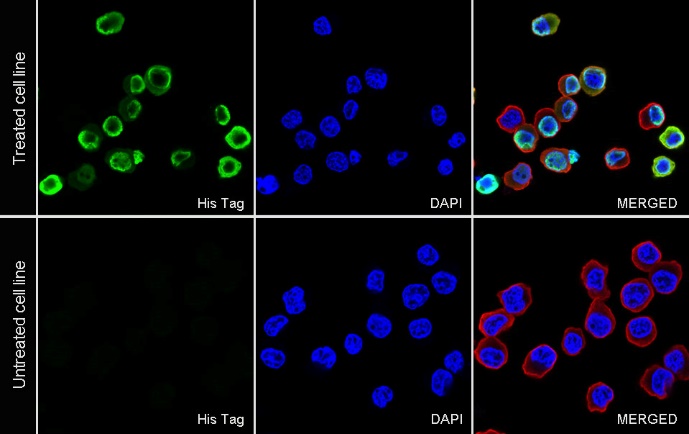 His标签蛋白纯化技术的原理与应用策略是什么？
