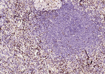 S100A4 Mouse Monoclonal Antibo