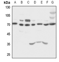 HSC70 Antibody [KO/KD Validate