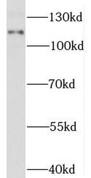 STAT2 Antibody抗体，orb631563，bio