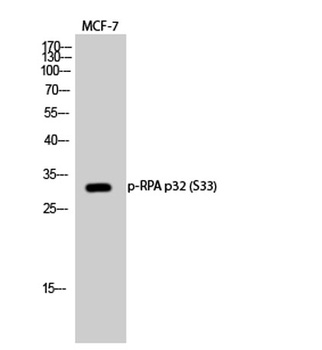 RPA p32 (phospho Ser33) rabbit