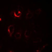 ILKAP Antibody抗体，orb665759，bio