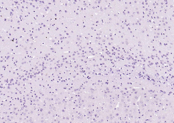 Cardiac Troponin I/TNIC Mouse 