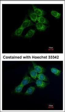 HSD17B4 antibody抗体,orb556120,b
