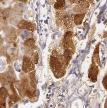 TF Antibody抗体，orb632105，biorby