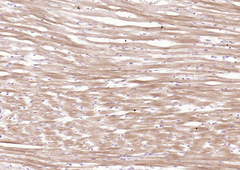 Cardiac Troponin I/TNIC Mouse 