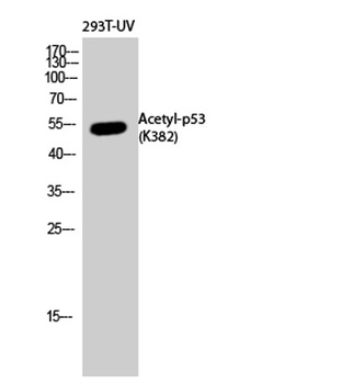 p53 (Acetyl Lys382) rabbit pAb