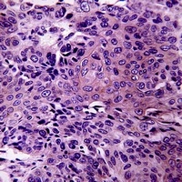 RhoBTB3 Antibody抗体，orb318886，b