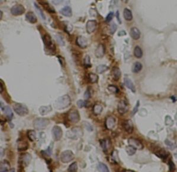 MAVS Antibody抗体，orb756615，bior