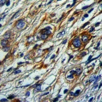 MCH Receptor 1 Antibody抗体，orb6