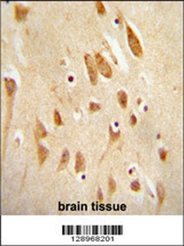 MAPK8 Antibody抗体，orb1270490，bi