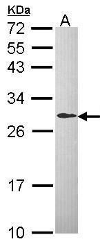MAD2L1 antibody [C2C3], C-term