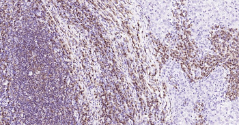 BOB1 Mouse Monoclonal Antibody