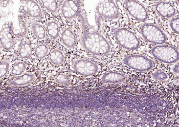 S100A4 Mouse Monoclonal Antibo