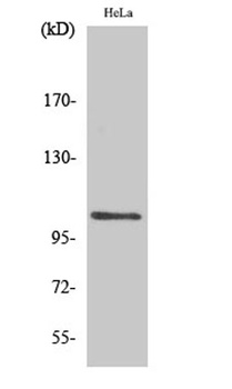 NFκB-p105 (phospho Ser927) rab