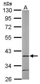 ARA9 antibody [N1C3]抗体，orb5567