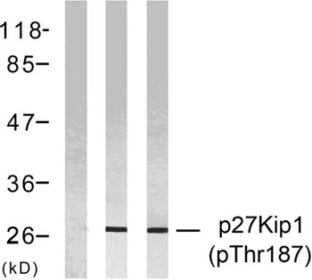 p27 (phospho Thr187) rabbit pA