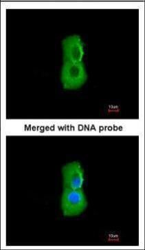 PSMC3 antibody [N1C2]抗体，orb556