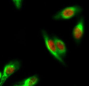 ERα rabbit pAb抗体，orb765177，bio