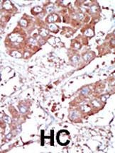 BMPR1A Antibody抗体，orb1271036，b